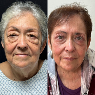 Slider image (8) Dr. Gabriel Sandoval - Plastic Surgeon in Mexico